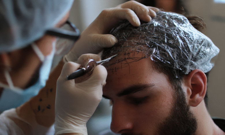 Hair Transplant Surgery